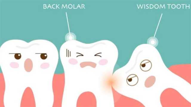 Treatment Options for Wisdom Teeth
