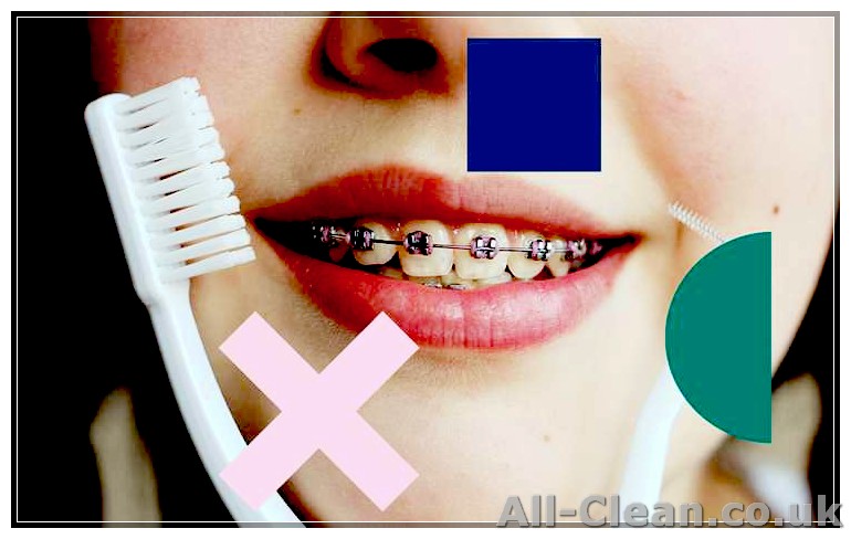 Top Tips for Cleaning Teeth With Braces: A Comprehensive Guide