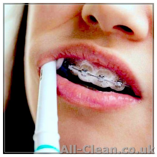 Top Tips for Cleaning Your Teeth With Braces